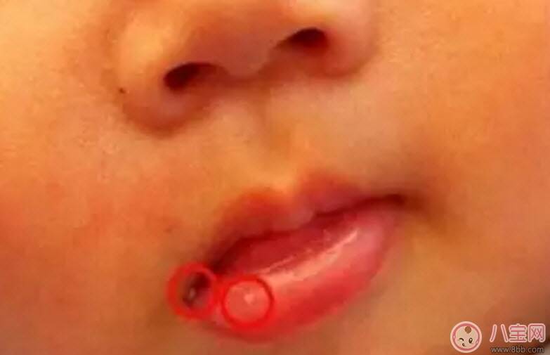 秋天怎么预防宝宝口角炎 宝宝口角炎的食疗方法