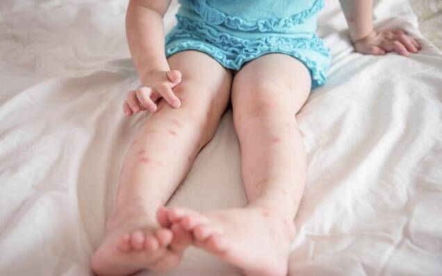 婴儿可以用电蚊香液吗 宝宝误吃了电蚊香液会中毒吗