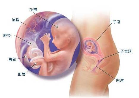 怀孕4个月能打胎吗？怀孕4个月感冒发烧怎么办？