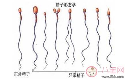 精子畸形率高能怀孕吗 精子畸形率高怎么办