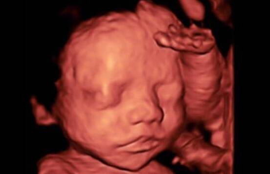 为什么胎儿喜欢捂着脸 四维胎儿为什么捂脸