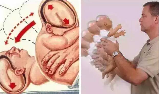 安抚宝宝的时候摇晃宝宝有什么影响 婴儿摇晃综合征是什么病