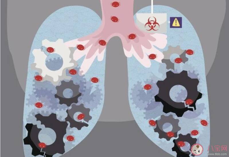 新冠肺炎患者的肺和SARS患者的区别是什么 新冠肺炎患者的肺和SARS患者的有哪些区别